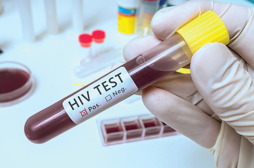 HIV- UND HEPATITIS-B-PATIENTEN